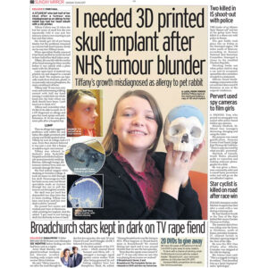 3D Printed Skull 300x300 - 3D_Printed_Skull